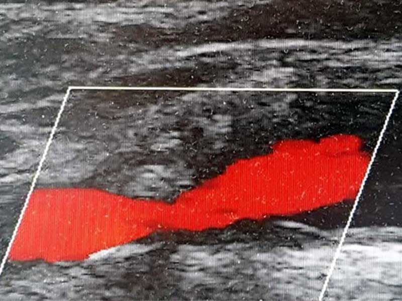 KC Leistungen Sonographie