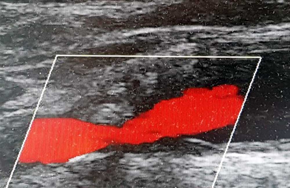 Sonographie