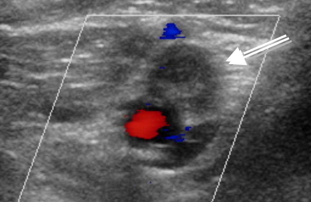 Sonographie